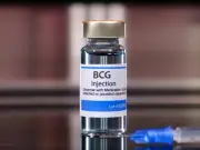 IMSS Oriente exhorta a detección temprana de tuberculosis en su Día Mundial