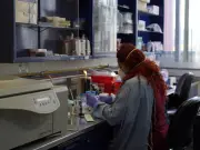 INER lidera detección temprana de tuberculosis con tecnología de vanguardia en México