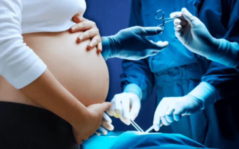 Alarma en México: Cesáreas excesivas afectan peso y talla de bebés al nacer