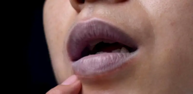 Cianosis: La Alerta Azul en la Piel que Indica Baja Oxigenación o Problemas Cardíacos