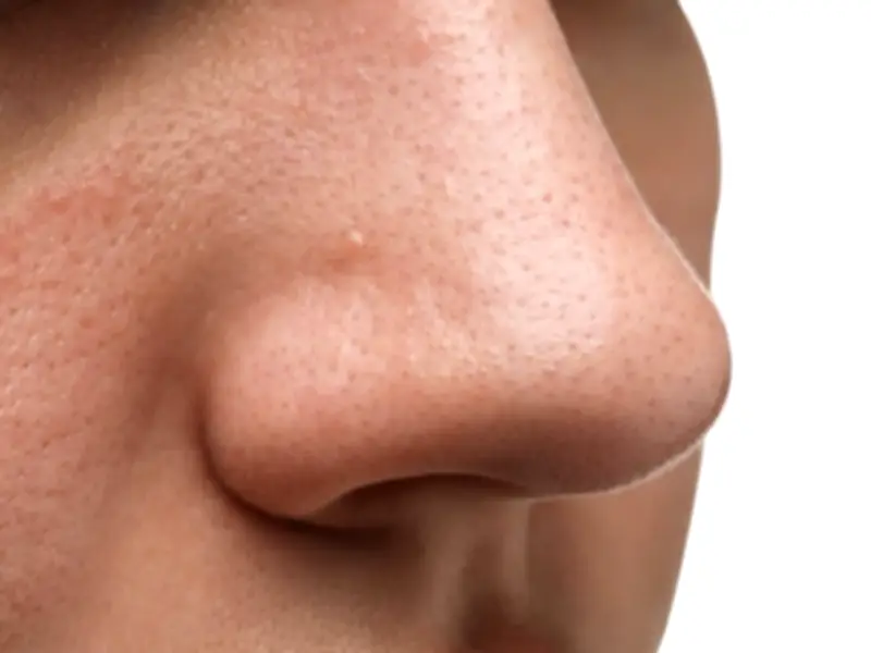 Crean el primer mapa detallado de los receptores olfativos en la nariz