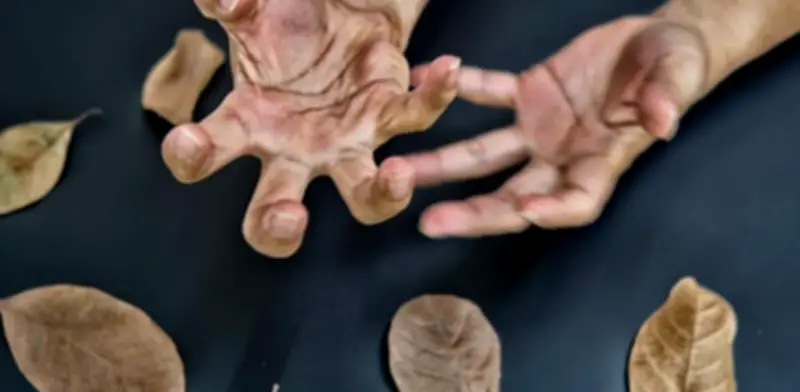 ¿El Parkinson tiene cura? Tratamientos y avances científicos para una vida activa