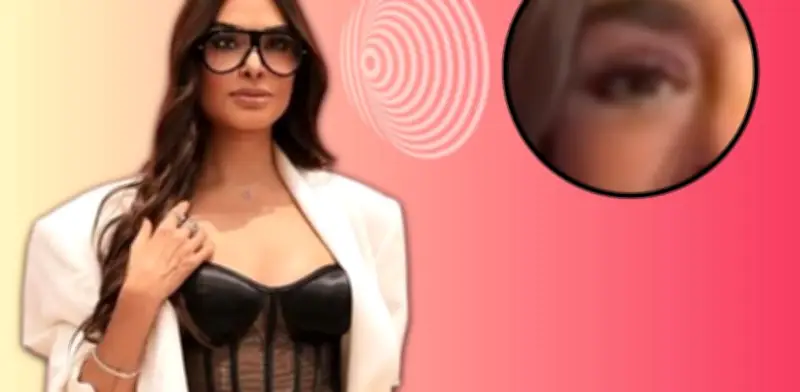 Galilea Montijo aclara rumores sobre su ojo tras tratamiento estético
