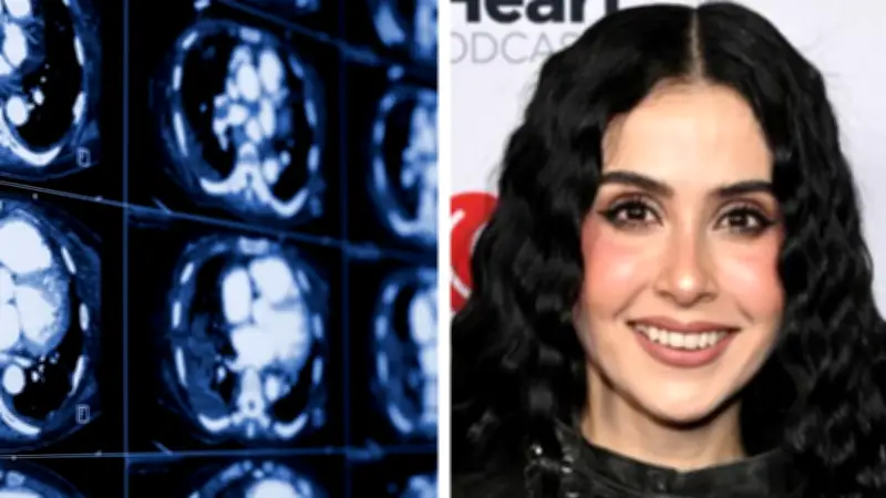 Hematoma Subdural: Diagnóstico que alejó a Lupita Villalobos de Supernova Génesis