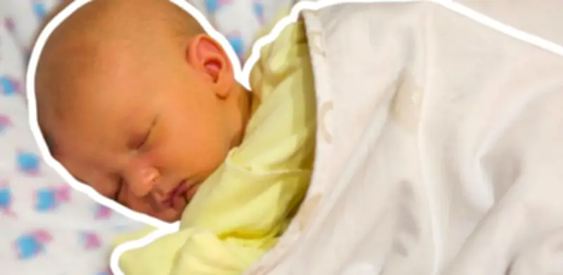 Ictericia en Bebés: La Explicación Médica del Tono Amarillo en Recién Nacidos