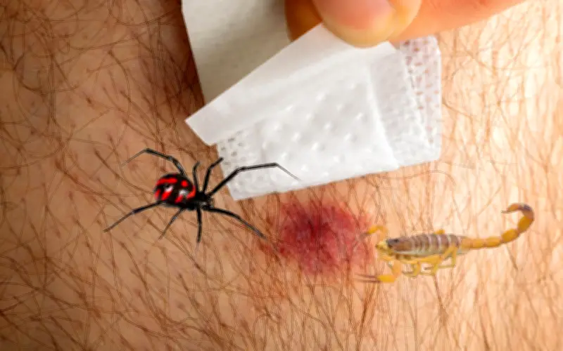 Jalisco: Guía Vital de Primeros Auxilios ante Picaduras de Araña o Alacrán