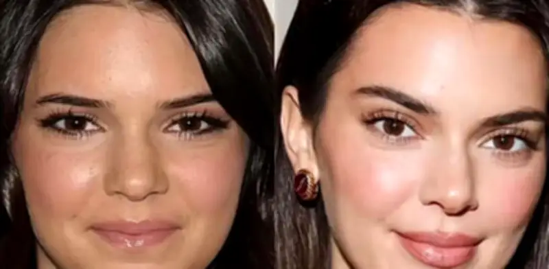 Kendall Jenner desmiente cirugías faciales y revela su experiencia con baby bótox