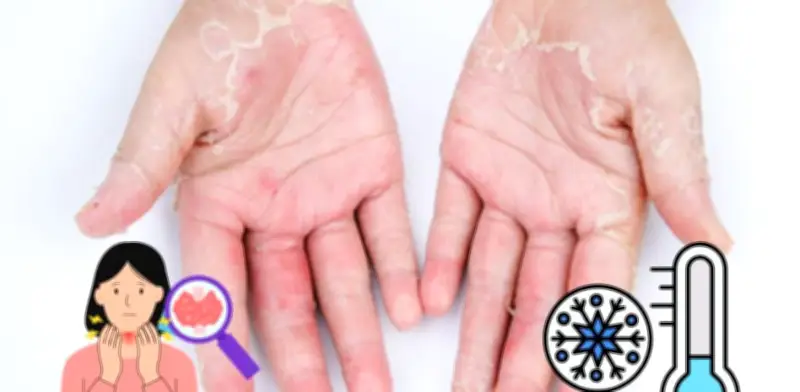 Piel seca persistente: ¿Cuándo es señal de una enfermedad subyacente?