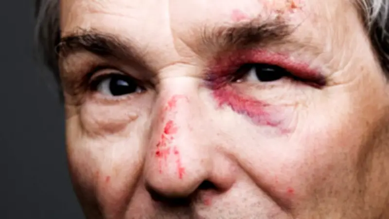 Video: presidente de condominio golpea a adulto mayor en Cholula, Puebla