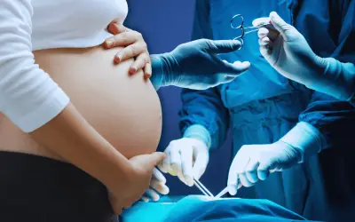 Alarma en México: Cesáreas excesivas afectan peso y talla de bebés al nacer