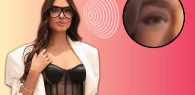 Galilea Montijo aclara rumores sobre su ojo tras tratamiento estético