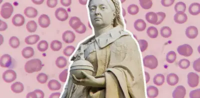La Reina Victoria y el Legado de la Hemofilia en las Casas Reales Europeas