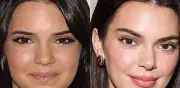 Kendall Jenner desmiente cirugías faciales y revela su experiencia con baby bótox
