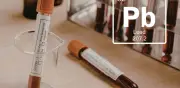 Plomo en la sangre: ¿Es normal tenerlo y cuál es el nivel seguro?