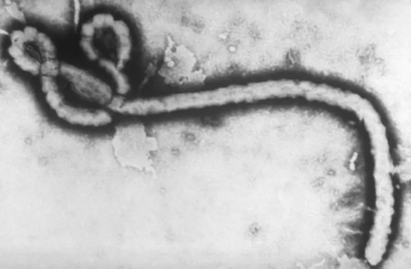 Alerta sanitaria por Ébola en África: primeros síntomas y prevención