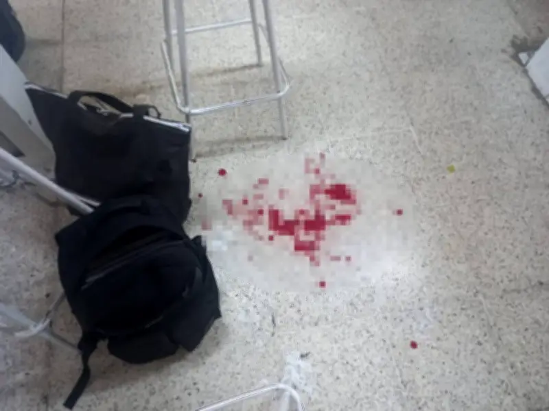 Alumno apuñala a maestro en secundaria de Huimanguillo, Tabasco; grave