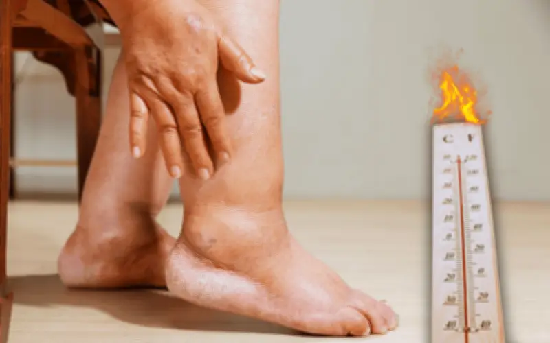 Cansancio y pesadez por el calor: la explicación médica
