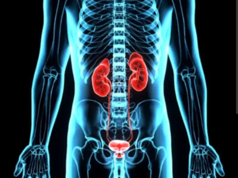 Cáncer de vejiga: sangre en orina, señal de alerta que no debes ignorar