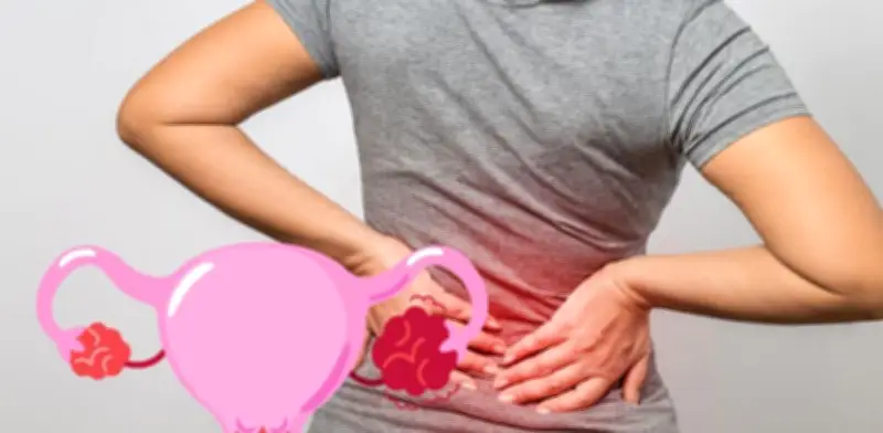 Dolor lumbar persistente: señal de alerta de cáncer de ovario