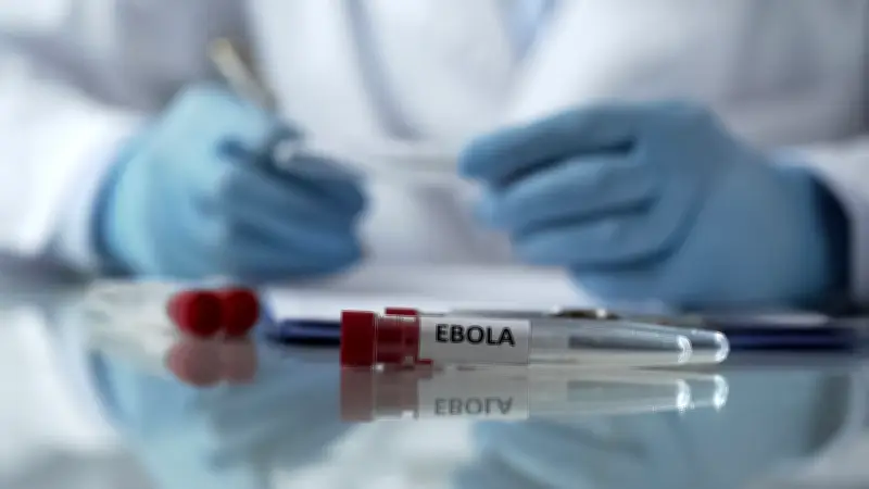 Médico estadounidense expuesto al ébola es hospitalizado en Chequia