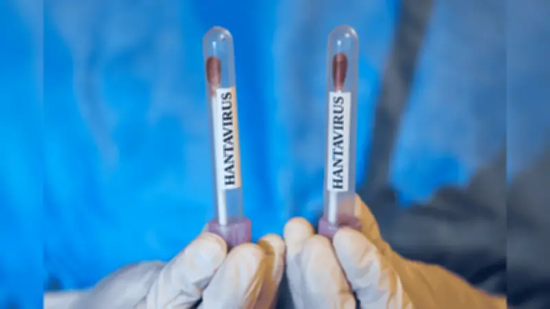 OMS descarta riesgo alto por hantavirus: no es un nuevo Covid