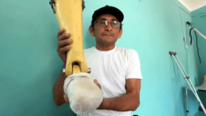 Pescador yucateco fabrica prótesis artesanal para su amigo amputado