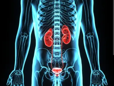 Cáncer de vejiga: sangre en orina, señal de alerta que no debes ignorar