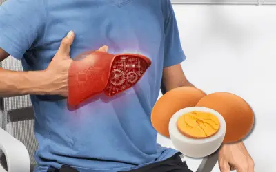 Hígado graso: ¿cuántos huevos al día se pueden comer?