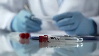 Médico estadounidense expuesto al ébola es hospitalizado en Chequia