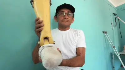 Pescador yucateco fabrica prótesis artesanal para su amigo amputado
