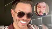 Bobby Norris impacta tras cirugía facial y enfrenta críticas