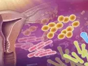 Causas y prevención de infecciones cervicovaginales en mujeres