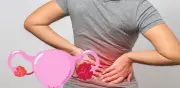Dolor lumbar persistente: señal de alerta de cáncer de ovario