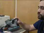 IMSS corrige asimetría facial con cirugía ortognática 3D de alta precisión