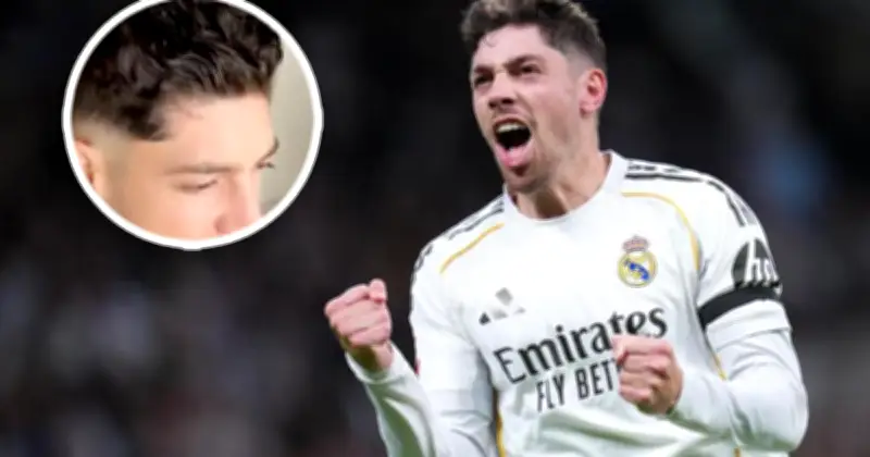 Federico Valverde muestra por primera vez la cicatriz del incidente con Tchouaméni