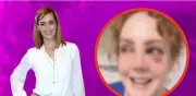 Fran Meric preocupa con ojo morado tras accidente doméstico