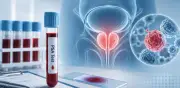 ¿Tacto rectal obligatorio para detectar cáncer de próstata? Expertos responden